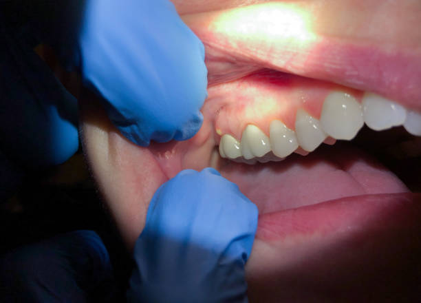 Best Pediatric Emergency Dentist in Bremen, OH